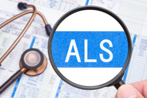 ALSとはどのような病気のこと？原因や症状・治療法について解説